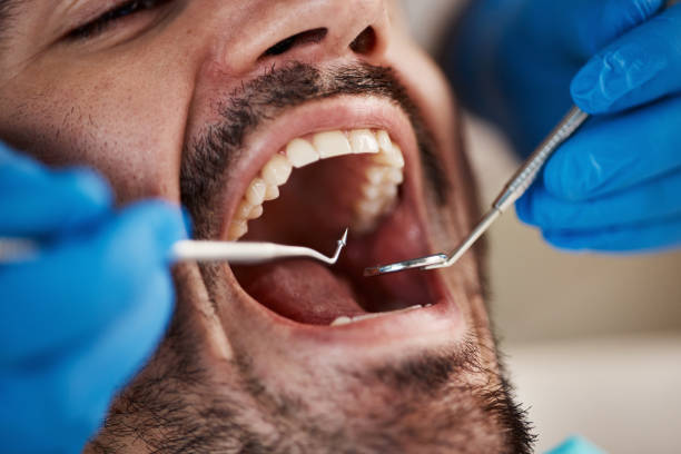 Best Emergency Tooth Extraction in Leitchfield, KY